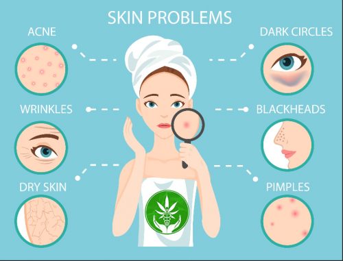 CBD Skin Benefits